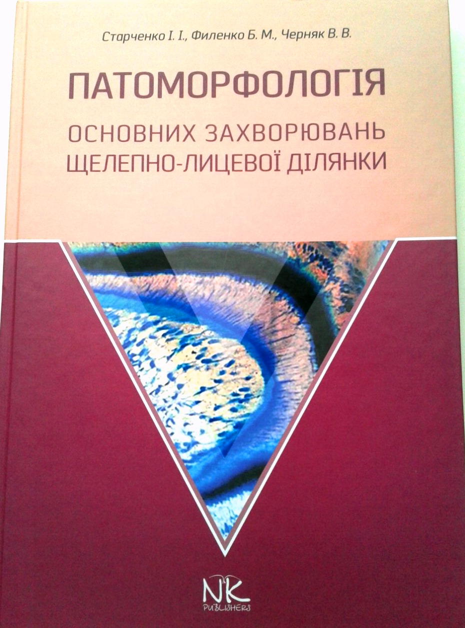 Патоморфологія основних захворювань щелепно-лицевої ділянки